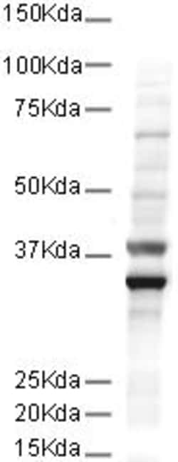 Abcam Mouse monoclonal [mAbcam 9484] to GAPDH - Loading Control, Quantity: