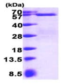 Abcam Recombinant Human Smad3 protein, 100UG, Quantity: Each of 1