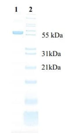 Abcam Native Human Human Serum Albumin protein, Quantity: Each of 1