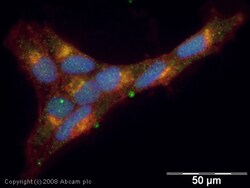 Abcam Rabbit polyclonal to PADI2 / PAD2, Quantity: Each of 1