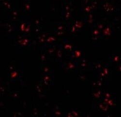 Abcam Rabbit polyclonal to IL-23, Quantity: Each of 1