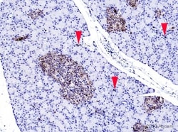 Abcam Rabbit polyclonal to Chromogranin A, Quantity: Each of 1