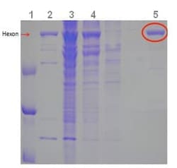 Abcam Native Adenovirus Type 5 hexon protein, 100UG