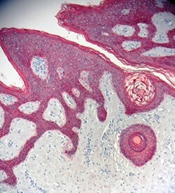 Biolegend Purified anti-Pan-Cytokeratin, Quantity: Each of 1