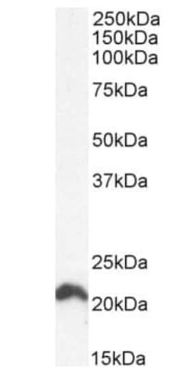 Abcam Goat polyclonal to NRAS, Quantity: Each of 1