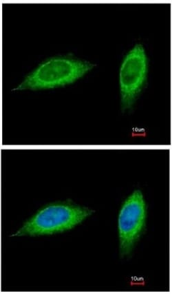 Abcam Rabbit polyclonal to MTHFD2, Quantity: Each of 1