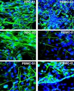 Abcam Chicken polyclonal to beta III Tubulin, Quantity: Each of 1