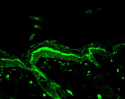 Abcam ANTI-DNA/RNA DAMAGE ATYDY100UG .., Quantity: Each of 1