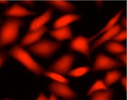 Abcam Live Cell Labeling Kit - Red Fluorescence - Cytopainter, Quantity: