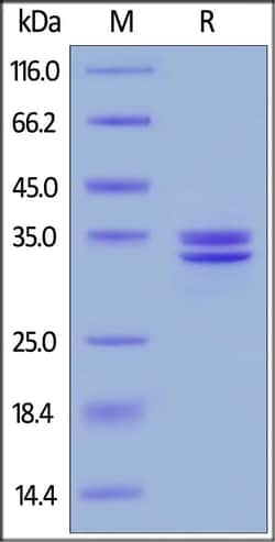 Abcam Recombinant human HMGB1 protein, Quantity: Each of 1