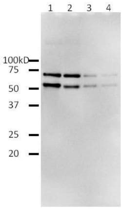 Abcam Recombinant HIV1 Reverse Transcriptase protein (Active), 200UNIT,