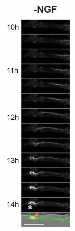 Abcam&nbsp;Kinetic Apoptosis Kit (Microscopy)