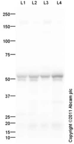 Abcam Rabbit polyclonal to CaMKII alpha, Quantity: Each of 1