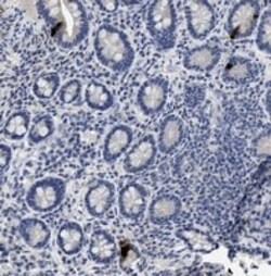 Abcam Mouse monoclonal [1] to Peptide YY/PYY, Quantity: Each of 1