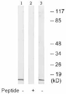 Abcam Rabbit polyclonal to NDUFA4, Quantity: Each of 1