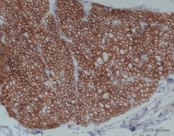 Abcam Anti-Fibronectin antibody [IST-9] - BSA and Azide free 100ug, Quantity: