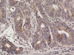 Abcam Rabbit polyclonal to Ras (mutated G12D), Quantity: Each of 1