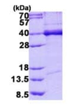 Abcam Recombinant Human TDP43 protein, 20UG, Quantity: Each of 1