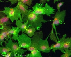 Abcam Rabbit polyclonal to Ihh, Quantity: Each of 1