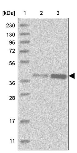 Abcam Rabbit polyclonal to DNAJB4, Quantity: Each of 1