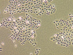 Lonza Walkersville NHEK-Ad - Human Epidermal Keratinocytes, Adult, Single