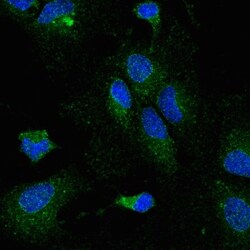 Abcam Mouse monoclonal [5D2] to Lipoprotein lipase, Quantity: Each of 1