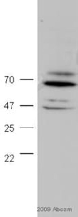 Abcam Rabbit polyclonal to FOXO1A, Quantity: Each of 1