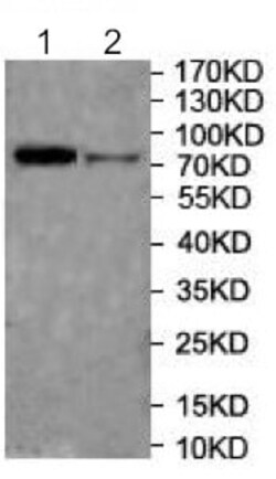 Abcam Rabbit polyclonal to DGKA, Quantity: Each of 1