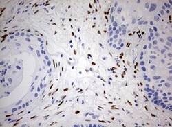Abcam Mouse monoclonal [OTI3G6] to ZEB1 - N-terminal, Quantity: Each of