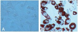 Abcam Adipogenesis Assay Kit (Cell-Based), Quantity: Each of 1