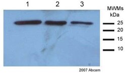 Abcam Rabbit polyclonal to SOD2/MnSOD, Quantity: Each of 1