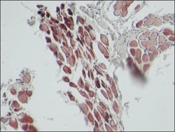 Abcam Mouse monoclonal [EA-53] to Sarcomeric Alpha Actinin, Quantity: Each