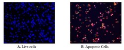 Abcam Apoptosis/ Necrosis Assay¿Kit (blue, red, green), Quantity: Each