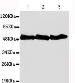 Abcam Mouse monoclonal [1E1-E8-H4] to beta Tubulin - Microtubule Marker,