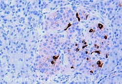Abcam Rabbit polyclonal to Somatostatin, Quantity: Each of 1