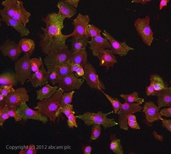 Abcam Mouse monoclonal [MEM-75] to Transferrin Receptor, Quantity: Each