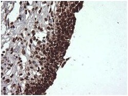 Abcam Mouse monoclonal [OTI1E1] to Von Hippel Lindau/VHL, Quantity: Each