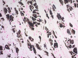 Abcam Fontana-Masson Stain Kit (Melanin Stain), Quantity: Each of 1