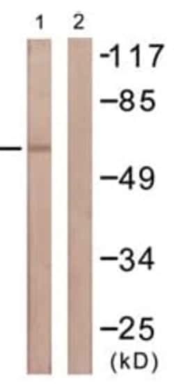 Abcam Rabbit polyclonal to TGF beta Receptor II, Quantity: Each of 1