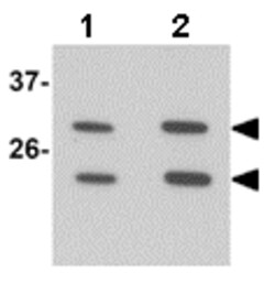 Abcam Rabbit polyclonal to MS4A6A, Quantity: Each of 1
