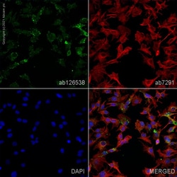 Abcam Rabbit polyclonal to LOX 1, Quantity: Each of 1