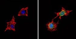 Abcam Rabbit polyclonal to PDE6D, Quantity: Each of 1