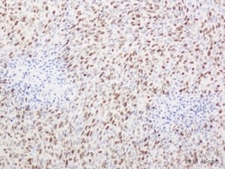 Abcam Rabbit polyclonal to Ki67, Quantity: Each of 1