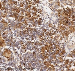 Abcam Rabbit polyclonal to Argonaute-2, Quantity: Each of 1