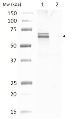 Abcam Rabbit polyclonal to GAD65 + GAD67, Quantity: Each of 1