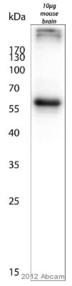 Abcam Chicken polyclonal to MAP2, Quantity: Each of 1
