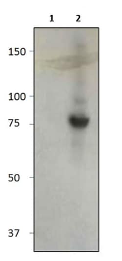 Abcam Rabbit polyclonal to BTK (phospho Y551), Quantity: Each of 1