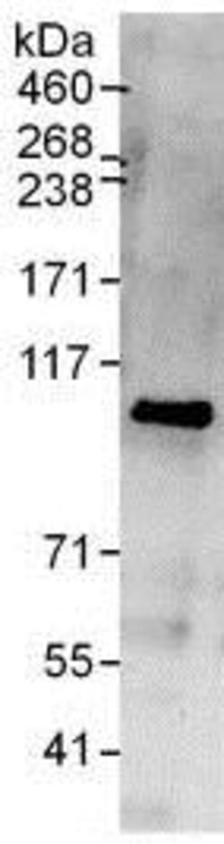 Abcam Rabbit polyclonal to EXOC1, Quantity: Each of 1