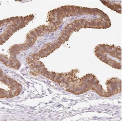 Abcam Rabbit polyclonal to CNDP2/CN2, Quantity: Each of 1