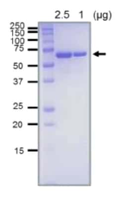 Abcam Recombinant E. coli RecQ DNA Helicase protein (Active), Quantity: